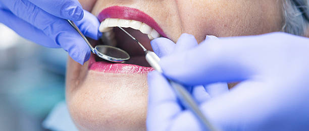 Best Emergency Root Canal Treatment in Morton Grove, IL