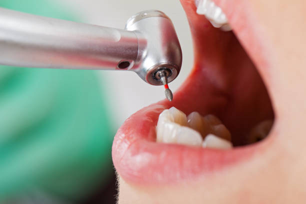 Best Emergency Gum Treatment in Morton Grove, IL